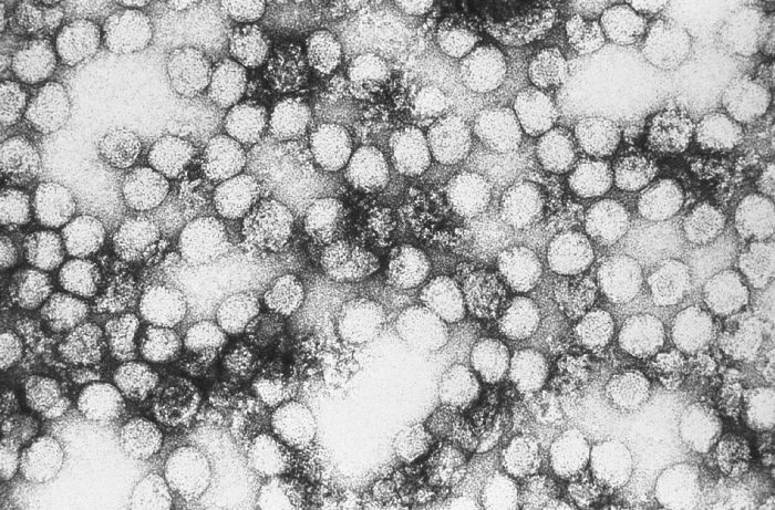 An electron micrograph of Yellow Fever Virus virions.